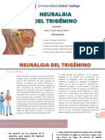Caso Clínico G5 Neuralgia Del Trigemino