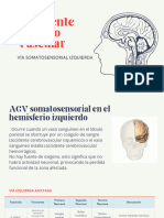 Accidente Cerebro Vascular: Vía Somatosensorial Izquierda