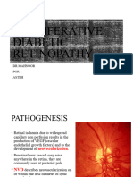 Proliferative Diabetic Retinopathy: DR Mahnoor PGR-1 Asteh