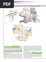 Arcos® Modular Femoral Revision Guide | PDF | Screw