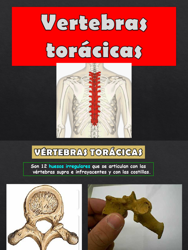 Vertebras Toracicas 3 Pdf Sistema Musculoesquelético Sistema