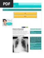 Chest X-Ray Abnormalities - Costophrenic Angle Blunting