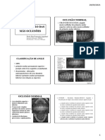 Classificação Das Más Oclusões Classificação Das Más Oclusões