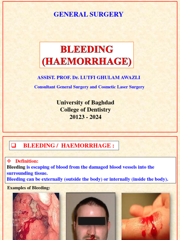 Dentistry l4 Bleeding PDF Bleeding Clinical Medicine
