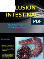 Obstruccion Intestinal