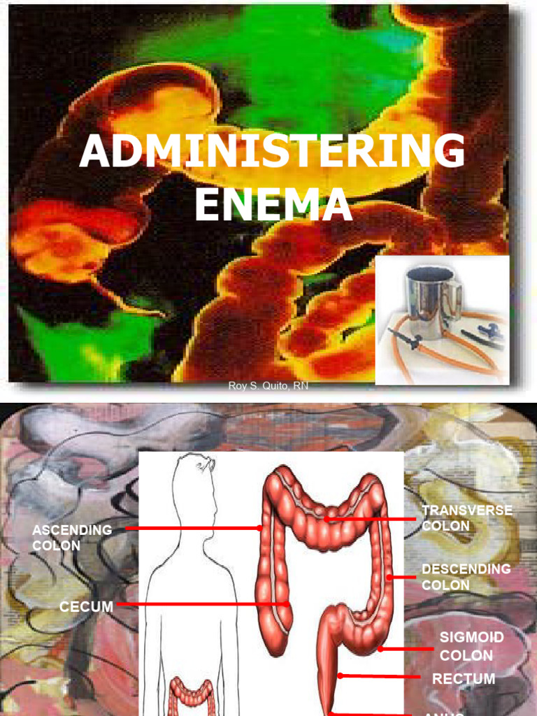 Enema Administration Guide for Nurses | PDF | Large Intestine | Rectum