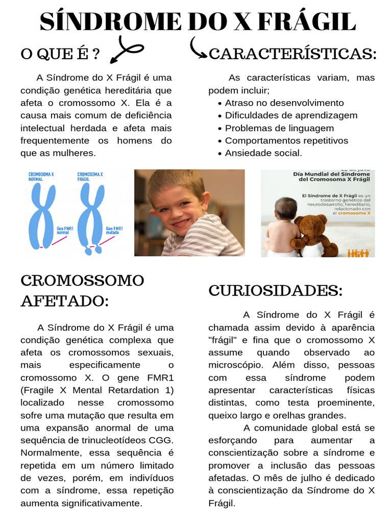 Síndrome Do X Frágil | PDF