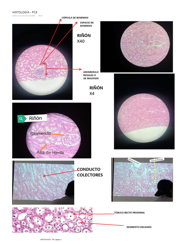 Histología del Riñón y Glándulas | PDF | Riñón | Epitelio