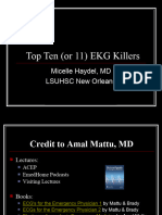 Top Ten (Or 11) EKG Killers