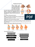 Rheumatoid Arthritis