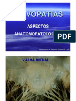 VALVOPATIAS ADQUIRIDAS - Doença Reumática