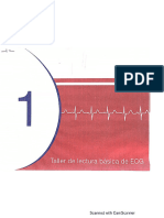 ECG