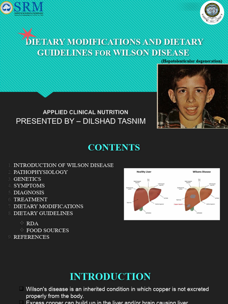 Wilson Disease PDF Dietary Supplements Nutrients