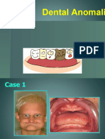 5.dental Anomalies PDF