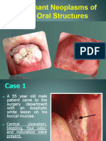 3.malignant Neoplasms 1 PDF