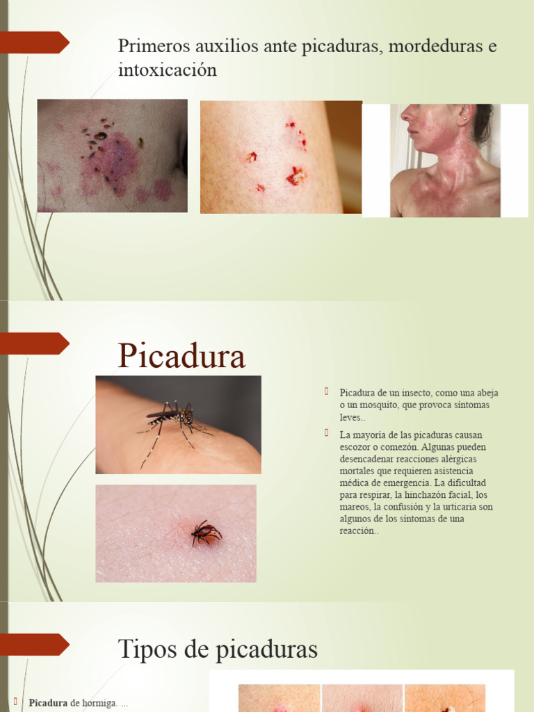 Picadura | PDF | Herida | Veneno