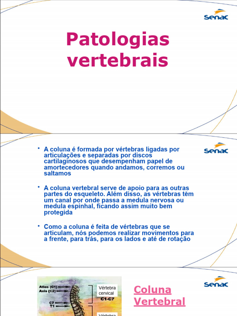Patologias da Coluna Vertebral e Tratamentos | PDF | Coluna vertebral ...