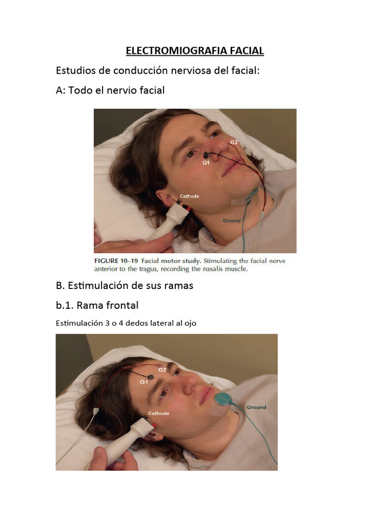 Electromiografía Facial y Nerviosa | PDF | Codo | Mano