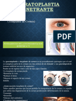 QUERATOPLASTIA