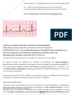 6 Claves para Aprender A Interpretar El Electrocardiograma