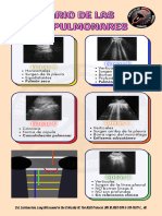 Lineas Pulmonares. Ultrasonido