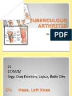 Tuberculous Arthritis