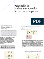 Descripción Del Electrocardiograma Normal y Lectura Del Electrocardiograma