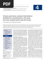 The Pulp, The Root-Treated Tooth and The Crown