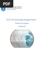 ECG HRV Assignment 19334107