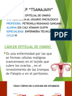 Cancer Epitelial de Ovario Sissi