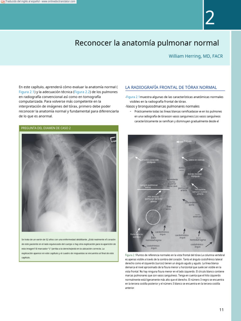 Anatomía Pulmonar en Radiografías | PDF | Tórax | Pulmón
