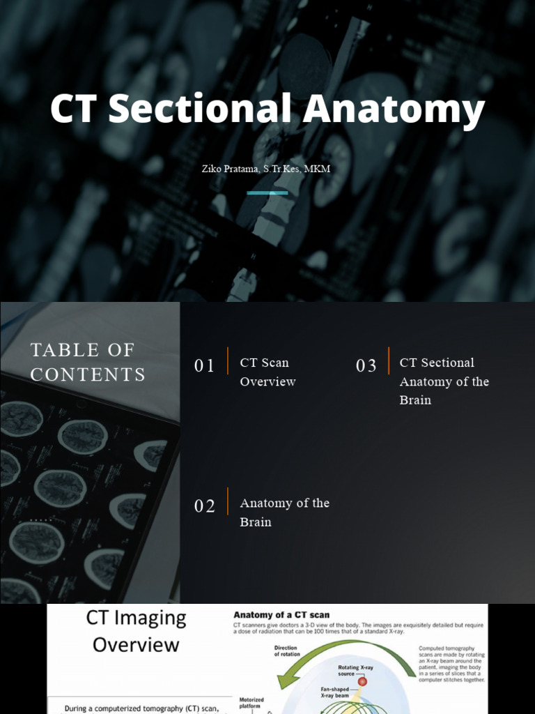 1 Anatomi CT - Brain | PDF