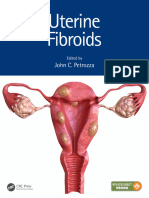 MCU 2021 Uterine Fibroids 1st Edition
