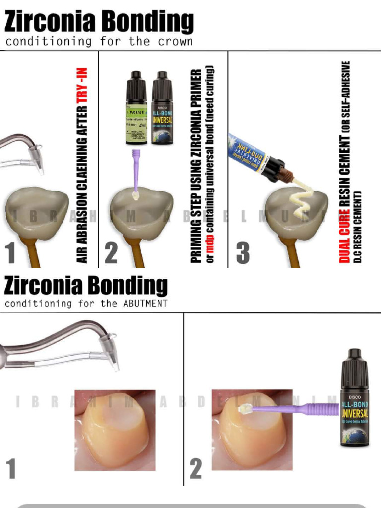 Zirconia Bonding DR Ibrahim | PDF