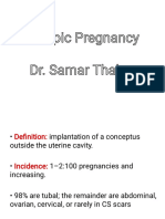 Ectopic Pregnancy Dr. Samar Thabet