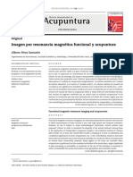 Acupuntura: Imagen Por Resonancia Magnética Funcional y Acupuntura