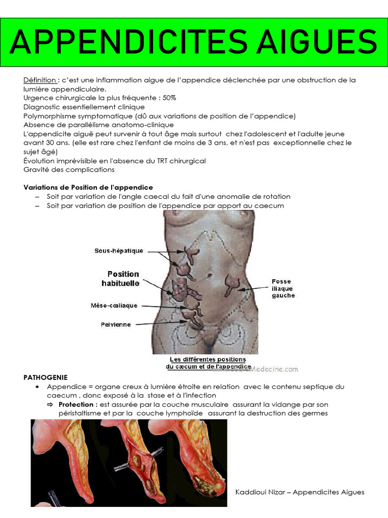 Appendicite Aiguë : Diagnostic et Causes | PDF | Spécialités médicales ...