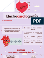 Electrocardiogram A