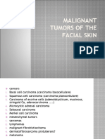 Malignant Tumors of The Facial Skin