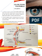 Cirurgia Ptose