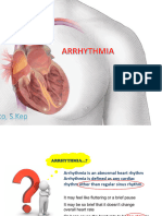 Aritmia Gangguan Pembentukan