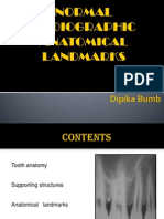normalradiographicanatomy-100401125921-phpapp02