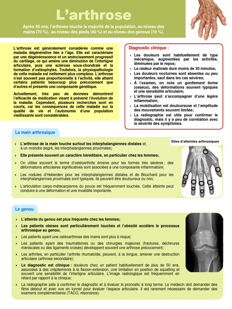 Arthrose de la main - Troubles osseux, articulaires et musculaires -  Manuels MSD pour le grand public