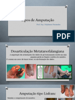 Tipos de Amputação