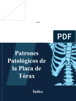 Patrones Patologicos de Torax