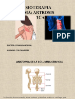 Artrosis Cervical