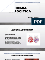 Leucemia Linfocitica