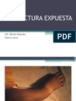 La Fractura Expuesta