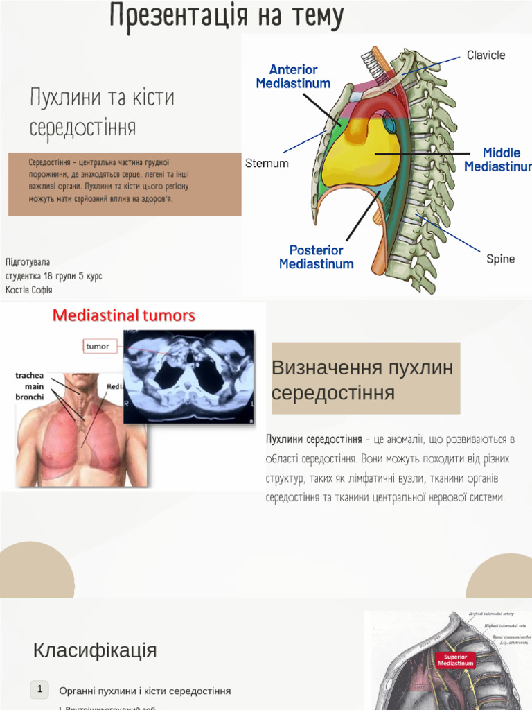 Tumors and Cysts of The Mediastinum | PDF