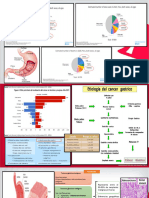 Neoplasia Gastrica